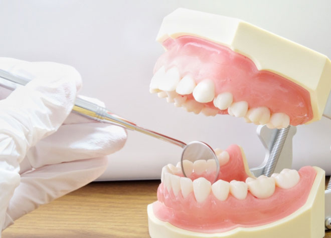 虫歯と歯周病は予防できます